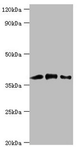 CAPG Antibody - Western blot All lanes: Macrophage-capping protein antibody at 1µg/ml Lane 1: Hela whole cell lysate Lane 2: NIH/3T3 whole cell lysate Lane 3: Rat lung tissue Secondary Goat polyclonal to rabbit IgG at 1/10000 dilution Predicted band size: 39, 37 kDa Observed band size: 39 kDa