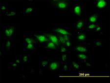 CAPG Antibody - Immunofluorescence of monoclonal antibody to CAPG on HeLa cell. [antibody concentration 10 ug/ml]