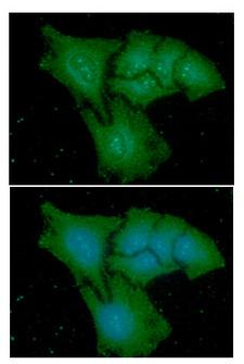 CAPG Antibody - ICC/IF analysis of CAPG in HeLa cells line, stained with DAPI (Blue) for nucleus staining and monoclonal anti-human CAPG antibody (1:100) with goat anti-mouse IgG-Alexa fluor 488 conjugate (Green).