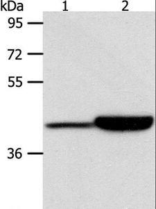 CAPG Antibody - Western blot analysis of Jurkat and RAW264.7 cell, using CAPG Polyclonal Antibody at dilution of 1:950.
