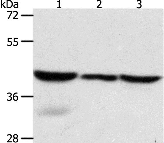 CAPG Antibody - Western blot analysis of Mouse lung and human fetal lung tissue, HeLa cell, using CAPG Polyclonal Antibody at dilution of 1:700.