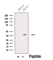 CAPG Antibody - Western blot analysis of extracts of HeLa cells using CAPG antibody. The lane on the left was treated with blocking peptide.
