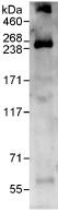 Capicua / CIC Antibody - CIC immunoprecipitated from Hela cell lysates with Rabbit Polyclonal anti-CIC.  This image was taken for the unconjugated form of this product. Other forms have not been tested.