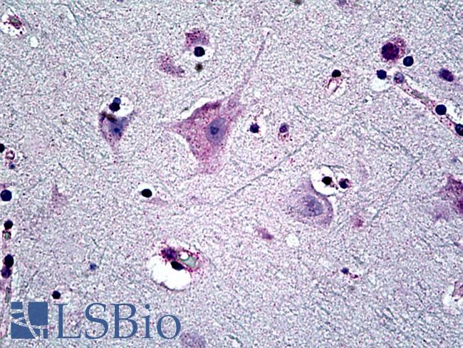 Capicua / CIC Antibody - Anti-CIC antibody IHC of human brain. Immunohistochemistry of formalin-fixed, paraffin-embedded tissue after heat-induced antigen retrieval. Antibody concentration 7.5 ug/ml. This image was taken for the unconjugated form of this product. Other forms have not been tested.