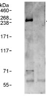 Capicua / CIC Antibody - Immunoprecipitation of CIC from HeLa cell lysates using antibody Capicua / CIC Antibody. Lane 2 shows extracts immunoprecipitated with an IgG control antibody. This image was taken for the unconjugated form of this product. Other forms have not been tested.