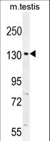 Capicua / CIC Antibody - CIC Antibody western blot of mouse testis tissue lysates (35 ug/lane). The CIC antibody detected the CIC protein (arrow).