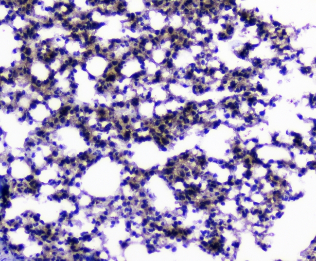 Capicua / CIC Antibody - IHC analysis of CIC using anti-CIC antibody. CIC was detected in paraffin-embedded section of mouse lung tissues. Heat mediated antigen retrieval was performed in citrate buffer (pH6, epitope retrieval solution) for 20 mins. The tissue section was blocked with 10% goat serum. The tissue section was then incubated with 1µg/ml rabbit anti-CIC Antibody overnight at 4°C. Biotinylated goat anti-rabbit IgG was used as secondary antibody and incubated for 30 minutes at 37°C. The tissue section was developed using Strepavidin-Biotin-Complex (SABC) with DAB as the chromogen.