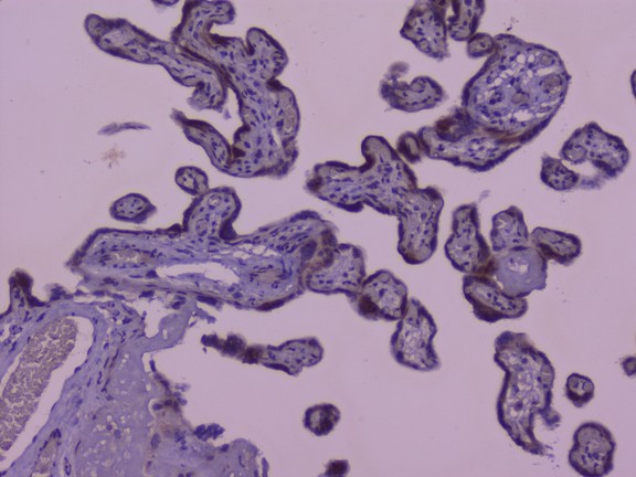 Capicua / CIC Antibody - IHC analysis of CIC using anti-CIC antibody. CIC was detected in paraffin-embedded section of human placenta tissue. Heat mediated antigen retrieval was performed in citrate buffer (pH6, epitope retrieval solution) for 20 mins. The tissue section was blocked with 10% goat serum. The tissue section was then incubated with 1µg/ml rabbit anti-CIC Antibody overnight at 4°C. Biotinylated goat anti-rabbit IgG was used as secondary antibody and incubated for 30 minutes at 37°C. The tissue section was developed using Strepavidin-Biotin-Complex (SABC) with DAB as the chromogen.