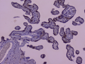 Capicua / CIC Antibody - IHC staining of FFPE human placenta with Capicua antibody at 1ug/ml. HIER: boil tissue sections in pH6, 10mM citrate buffer, for 10-20 min followed by cooling at RT for 20 min.