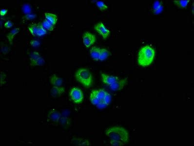 CAPN1 / Calpain 1 Antibody - Immunofluorescence staining of MCF-7 cells with CAPN1 Antibody at 1:200, counter-stained with DAPI. The cells were fixed in 4% formaldehyde, permeabilized using 0.2% Triton X-100 and blocked in 10% normal Goat Serum. The cells were then incubated with the antibody overnight at 4°C. The secondary antibody was Alexa Fluor 488-congugated AffiniPure Goat Anti-Rabbit IgG(H+L).