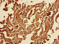 CAPN1 / Calpain 1 Antibody - Immunohistochemistry of paraffin-embedded human heart tissue using CAPN1 Antibody at dilution of 1:100