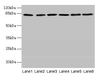 CAPN1 / Calpain 1 Antibody - Western blot All lanes: CAPN1 antibody at 6µg/ml Lane 1: A375 whole cell lysate Lane 2: 293T whole cell lysate Lane 3: PC-3 whole cell lysate Lane 4: Jurkat whole cell lysate Lane 5: Hela whole cell lysate Lane 6: A2780 whole cell lysate Secondary Goat polyclonal to rabbit IgG at 1/10000 dilution Predicted band size: 82 kDa Observed band size: 82 kDa