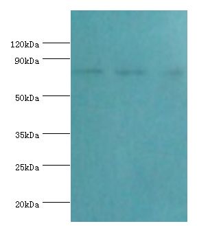 CAPN1 / Calpain 1 Antibody - Western blot. All lanes: Calpain-1 catalytic subunit antibody at 2 ug/ml. Lane 1: A431 whole cell lysate. Lane 2: HeLa whole cell lysate. Lane 3: Jurkat whole cell lysate. Secondary antibody: Goat polyclonal to rabbit at 1:10000 dilution. Predicted band size: 82 kDa. Observed band size: 82 kDa.