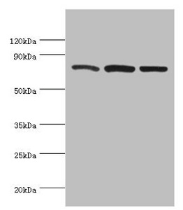 CAPN1 / Calpain 1 Antibody - Western blot All lanes: Calpain-1 catalytic subunit antibody at 2µg/ml Lane 1: A431 whole cell lysate Lane 2: Hela whole cell lysate Lane 3: Jurkat whole cell lysate Secondary Goat polyclonal to rabbit IgG at 1/10000 dilution Predicted band size: 82 kDa Observed band size: 82 kDa