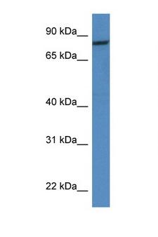 CAPN1 / Calpain 1 Antibody - CAPN1 / Calpain 1 antibody Western blot of HT1080 Cell lysate. Antibody concentration 1 ug/ml.  This image was taken for the unconjugated form of this product. Other forms have not been tested.
