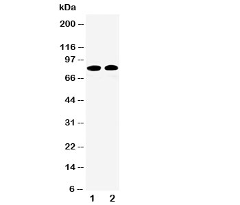 CAPN1 / Calpain 1 Antibody - Western blot testing of Calpain 1 antibody and Lane 1: HT1080; 2: COLO320 cell lysate. Predicted/observed size ~82KD