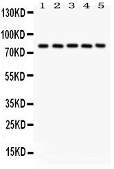 CAPN1 / Calpain 1 Antibody - Calpain1 antibody Western blot. All lanes: Anti Calpain1 at 0.5 ug/ml. Lane 1: Rat Lung Tissue Lysate at 50 ug. Lane 2: Mouse Lung Tissue Lysate at 50 ug. Lane 3: A549 Whole Cell Lysate at 40 ug. Lane 4: COLO320 Whole Cell Lysate at 40 ug. Lane 5: JURKAT Whole Cell Lysate at 40 ug. Predicted band size: 82 kD. Observed band size: 82 kD.