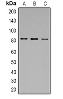 CAPN1 / Calpain 1 Antibody - Western blot analysis of Calpain 1 expression in A549 (A); MCF7 (B); Jurkat (C) whole cell lysates.