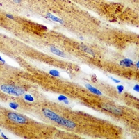 CAPN1 / Calpain 1 Antibody - Immunohistochemical analysis of Calpain 1 staining in mouse heart formalin fixed paraffin embedded tissue section. The section was pre-treated using heat mediated antigen retrieval with sodium citrate buffer (pH 6.0). The section was then incubated with the antibody at room temperature and detected using an HRP conjugated compact polymer system. DAB was used as the chromogen. The section was then counterstained with hematoxylin and mounted with DPX.