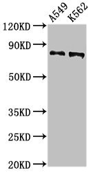 CAPN1 / Calpain 1 Antibody - Western Blot Positive WB detected in:A549 whole cell lysat,K562 whole cell lysate All Lanes:CAPN1 antibody at 2.7µg/ml Secondary Goat polyclonal to rabbit IgG at 1/50000 dilution Predicted band size: 82 KDa Observed band size: 82 KDa