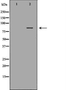 CAPN1 / Calpain 1 Antibody - Western blot analysis of HeLa cell lysates using CAPN1 antibody. The lane on the left is treated with the antigen-specific peptide.