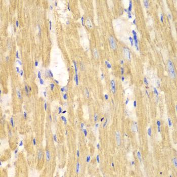 CAPN1 / Calpain 1 Antibody - Immunohistochemistry of paraffin-embedded Mouse heart using CAPN1 Polyclonal Antibody at dilution of 1:100 (40x lens).