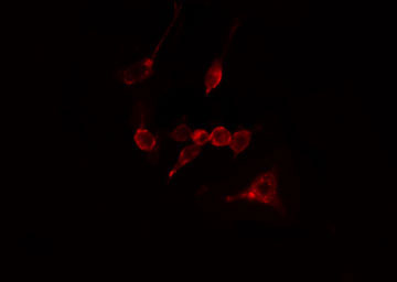 CAPN10 / Calpain 10 Antibody - Staining LOVO cells by IF/ICC. The samples were fixed with PFA and permeabilized in 0.1% Triton X-100, then blocked in 10% serum for 45 min at 25°C. The primary antibody was diluted at 1:200 and incubated with the sample for 1 hour at 37°C. An Alexa Fluor 594 conjugated goat anti-rabbit IgG (H+L) antibody, diluted at 1/600, was used as secondary antibody.