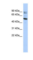 CAPN10 / Calpain 10 Antibody - CAPN10 / Calpain 10 antibody Western blot of HT1080 cell lysate. This image was taken for the unconjugated form of this product. Other forms have not been tested.