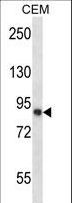 CAPN11 / Calpain 11 Antibody - CAPN11 Antibody western blot of CEM cell line lysates (35 ug/lane). The CAPN11 antibody detected the CAPN11 protein (arrow).