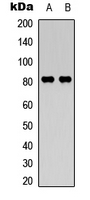 CAPN11 / Calpain 11 Antibody - Western blot analysis of Calpain 11 expression in HeLa (A); Jurkat (B) whole cell lysates.
