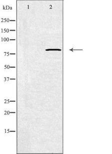 CAPN11 / Calpain 11 Antibody - Western blot analysis of extracts of HepG2 cells using CAPN11 antibody. The lane on the left is treated with the antigen-specific peptide.