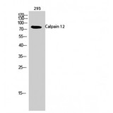 CAPN12 / Calpain 12 Antibody - Western blot of Calpain 12 antibody