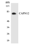 CAPN12 / Calpain 12 Antibody - Western blot analysis of the lysates from K562 cells using CAPN12 antibody.