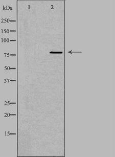 CAPN12 / Calpain 12 Antibody - Western blot analysis of extracts of NIH-3T3 cells using CAPN12 antibody. The lane on the left is treated with the antigen-specific peptide.
