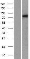 CAPN12 / Calpain 12 Protein - Western validation with an anti-DDK antibody * L: Control HEK293 lysate R: Over-expression lysate