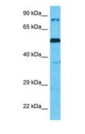 CAPN14 Antibody - Western blot of CAPN14 Antibody with human MCF7 Whole Cell lysate.  This image was taken for the unconjugated form of this product. Other forms have not been tested.