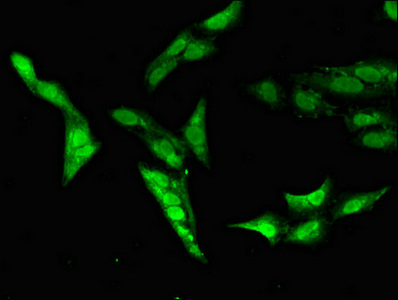 CAPN14 Antibody - Immunofluorescent analysis of Hela cells diluted at 1:100 and Alexa Fluor 488-congugated AffiniPure Goat Anti-Rabbit IgG(H+L)