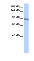 CAPN15 / SOLH Antibody - SOLH antibody Western blot of Fetal Lung lysate. This image was taken for the unconjugated form of this product. Other forms have not been tested.