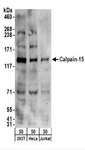 CAPN15 / SOLH Antibody - Detection of Human Calpain-15 by Western Blot. Samples: Whole cell lysate (50 ug) from 293T, HeLa, and Jurkat cells. Antibodies: Affinity purified rabbit anti-Calpain-15 antibody used for WB at 0.2 ug/ml. Detection: Chemiluminescence with an exposure time of 3 minutes.