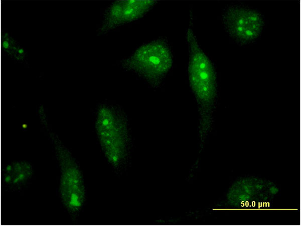 CAPN15 / SOLH Antibody - Immunofluorescence of monoclonal antibody to SOLH on HeLa cell . [antibody concentration 10 ug/ml]
