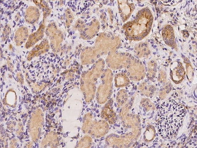 CAPN15 / SOLH Antibody - Immunochemical staining of human SOLH in human kidney with rabbit polyclonal antibody at 1:100 dilution, formalin-fixed paraffin embedded sections.