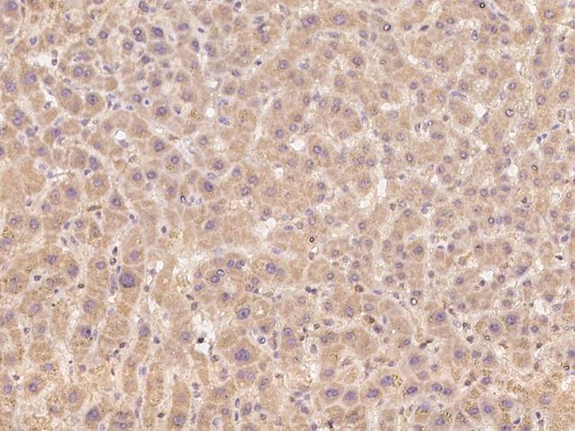 CAPN15 / SOLH Antibody - Immunochemical staining of human SOLH in human liver with rabbit polyclonal antibody at 1:100 dilution, formalin-fixed paraffin embedded sections.