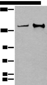 CAPN15 / SOLH Antibody - Western blot analysis of Hela and A172 cell lysates  using CAPN15 Polyclonal Antibody at dilution of 1:400