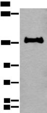 CAPN15 / SOLH Antibody - Western blot analysis of 231 cell lysate  using CAPN15 Polyclonal Antibody at dilution of 1:450