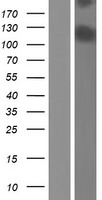 CAPN15 / SOLH Protein - Western validation with an anti-DDK antibody * L: Control HEK293 lysate R: Over-expression lysate