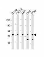 CAPN2 / Calpain 2 / M-Calpain Antibody - All lanes : Anti-CAPN2 Antibody at 1:8000 dilution Lane 1: rat lung lysates Lane 2: C2C12 whole cell lysates Lane 3: A431 whole cell lysates Lane 4: HeLa whole cell lysates Lane 5: PC-3 whole cell lysates Lysates/proteins at 20 ug per lane. Secondary Goat Anti-Rabbit IgG, (H+L), Peroxidase conjugated at 1/10000 dilution Predicted band size : 80 kDa Blocking/Dilution buffer: 5% NFDM/TBST.