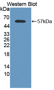 CAPN2 / Calpain 2 / M-Calpain Antibody - Western blot of CAPN2 / Calpain 2 / M-Calpain antibody.