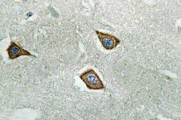 CAPN2 / Calpain 2 / M-Calpain Antibody - IHC of Calpain2 (K354) pAb in paraffin-embedded human brain tissue.