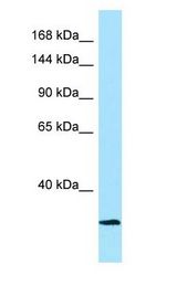 CAPN3 / Calpain 3 Antibody - CAPN3 / Calpain 3 antibody Western Blot of HT1080.  This image was taken for the unconjugated form of this product. Other forms have not been tested.