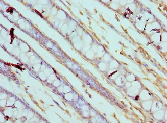 CAPN3 / Calpain 3 Antibody - Immunohistochemistry of paraffin-embedded human rectum using antibody at 1:100 dilution.